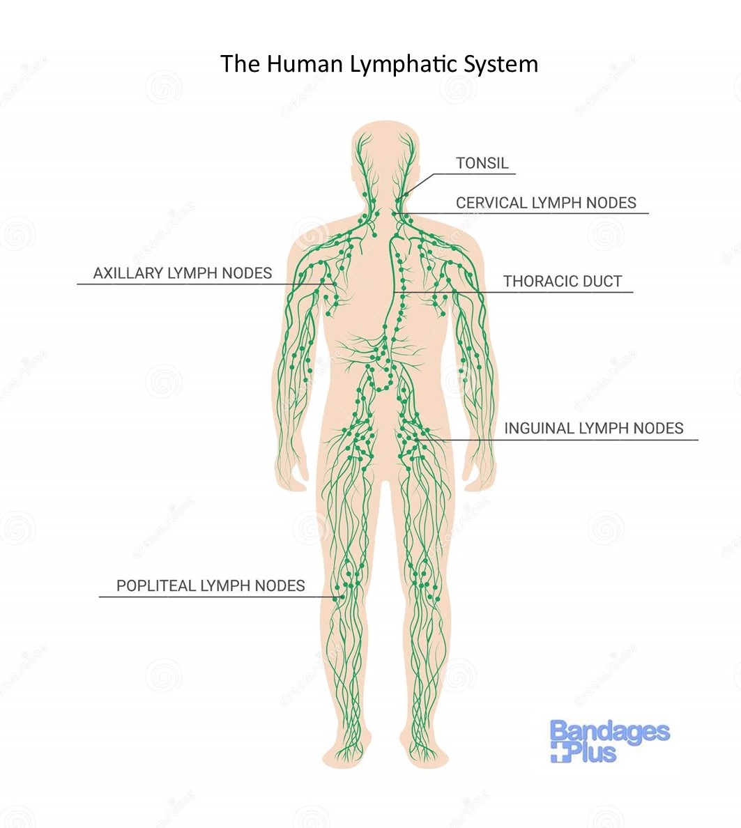 Lymphedema | Lymphedema Symptoms | Lymphedema Treatment
