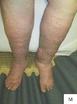 Patient after treatment