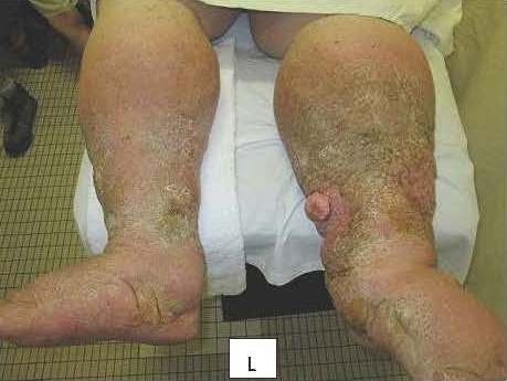 Patient before treatment