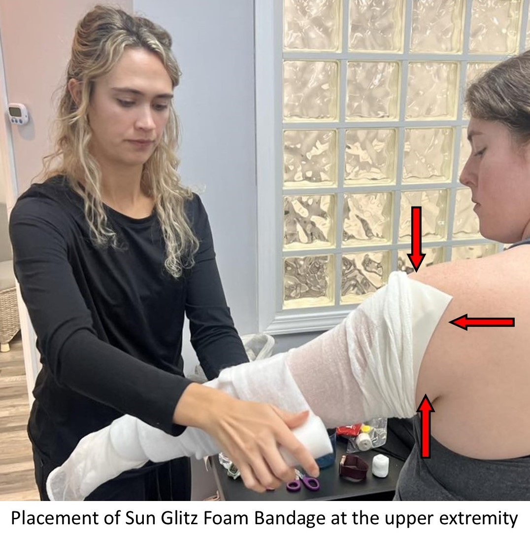 Sun Glitz Foam Bandage at the upper extremity